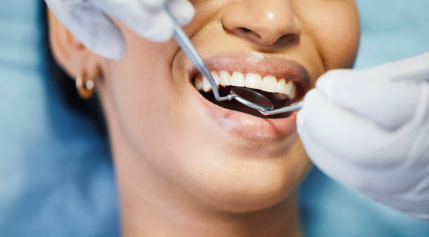 Best Emergency Dentist for Knocked-Out Tooth in , UT